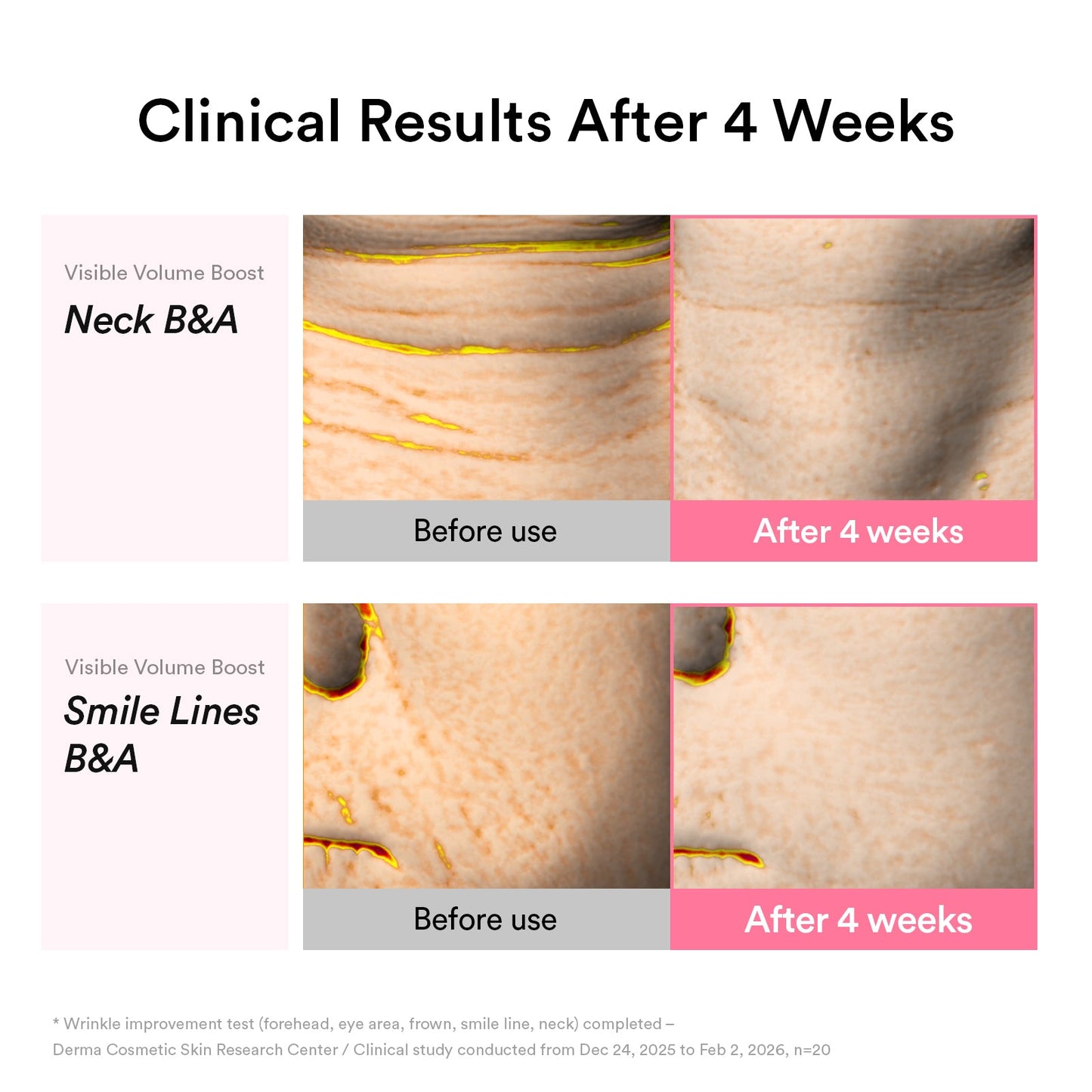 PDRN Volume fill-it Booster crème 2.5 tube