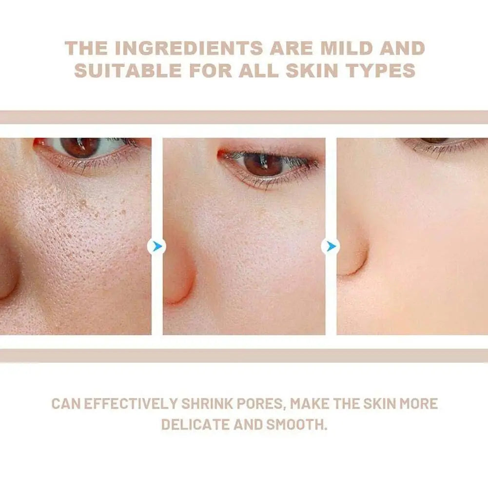 🔥2025 Hot Sale(💥20%OFF)🔥Whitening Exfoliating Essence